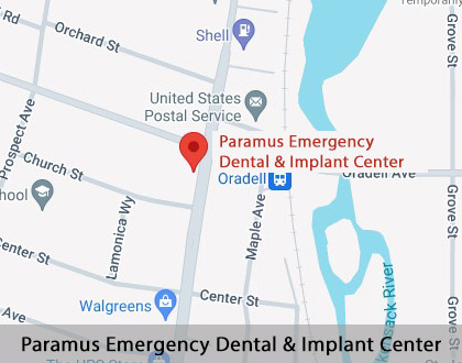 Map image for Can a Cracked Tooth be Saved with a Root Canal and Crown in Oradell, NJ