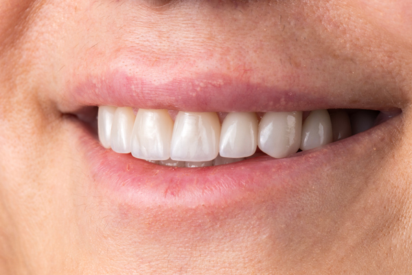 Reasons To Consider A General Dentist For Orthodontic Treatment